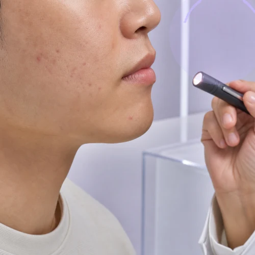 위례피부과 통근·마찰·화장품 전환을 분리하는 트러블 회랑 | 위례피부과 정보 대표 이미지